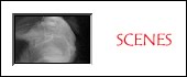 Sc�nes